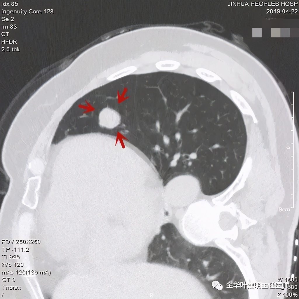 误诊报告图片,误诊案例及案例分析