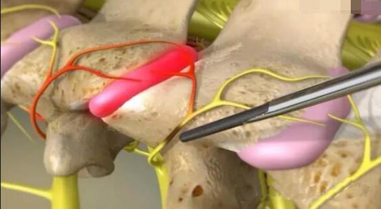 手脚冰凉耳鸣头昏,头痛头晕四肢无力怎么调理