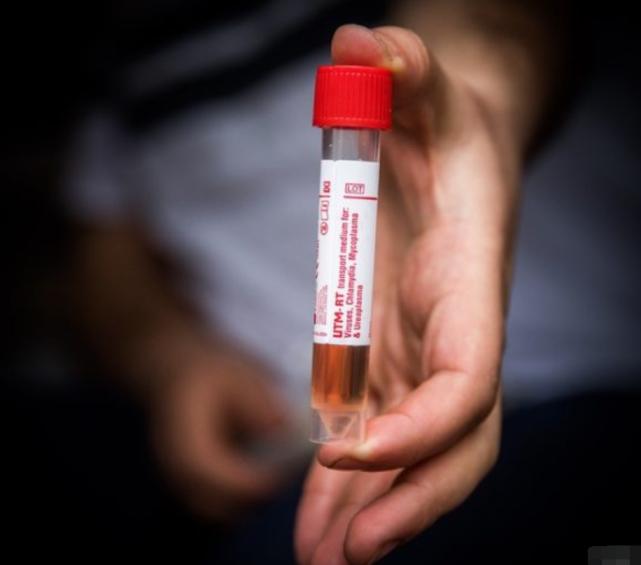 以色列买的10万个新冠病毒试剂盒到货了，正高兴时，却发现买错了