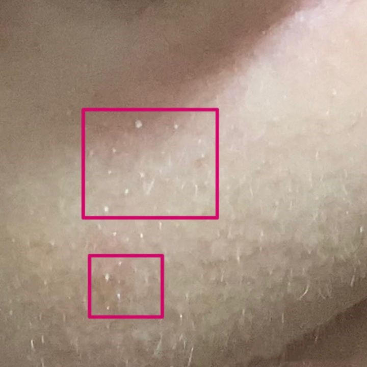 为啥要去脸部角质,为什么要去皮肤上的角质