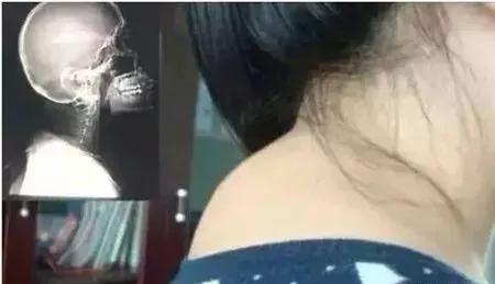 身体各部位的寿命对照表,身体各部位寿命对照表