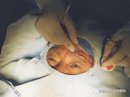 龙岩二院眼科预约电话,龙岩二院眼科在东院吗