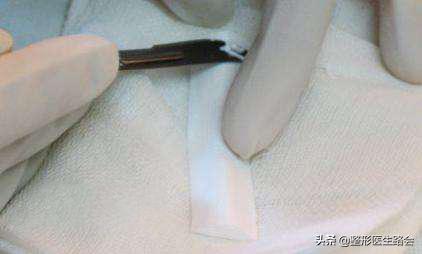 鼻子的鼻梁塌下来了怎么提上来,塌鼻子如何让鼻梁变高变挺