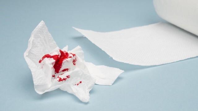 痔疮出血,多少出血量会对身体造成伤害?只是做到止血可不够