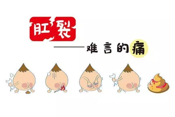 肛裂难言之隐,肛裂难以治愈