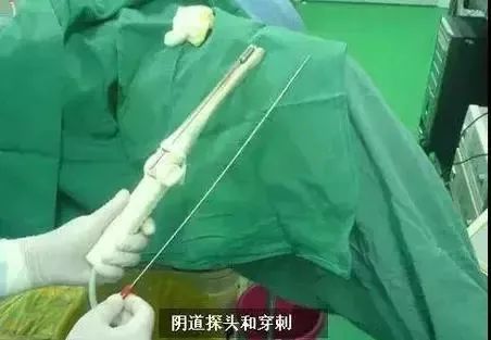 代孕弃养事件女星,代孕弃养被曝光