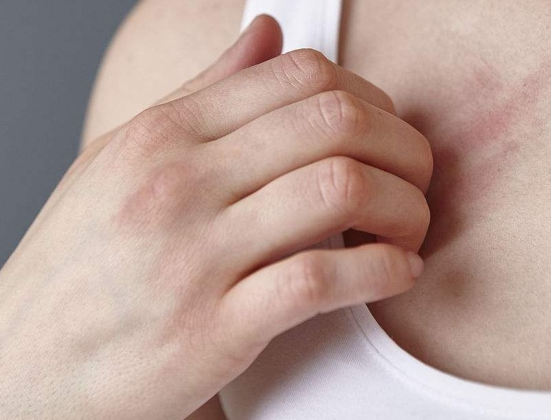 长期的胸部痒,胸部很痒是什么原因引起的