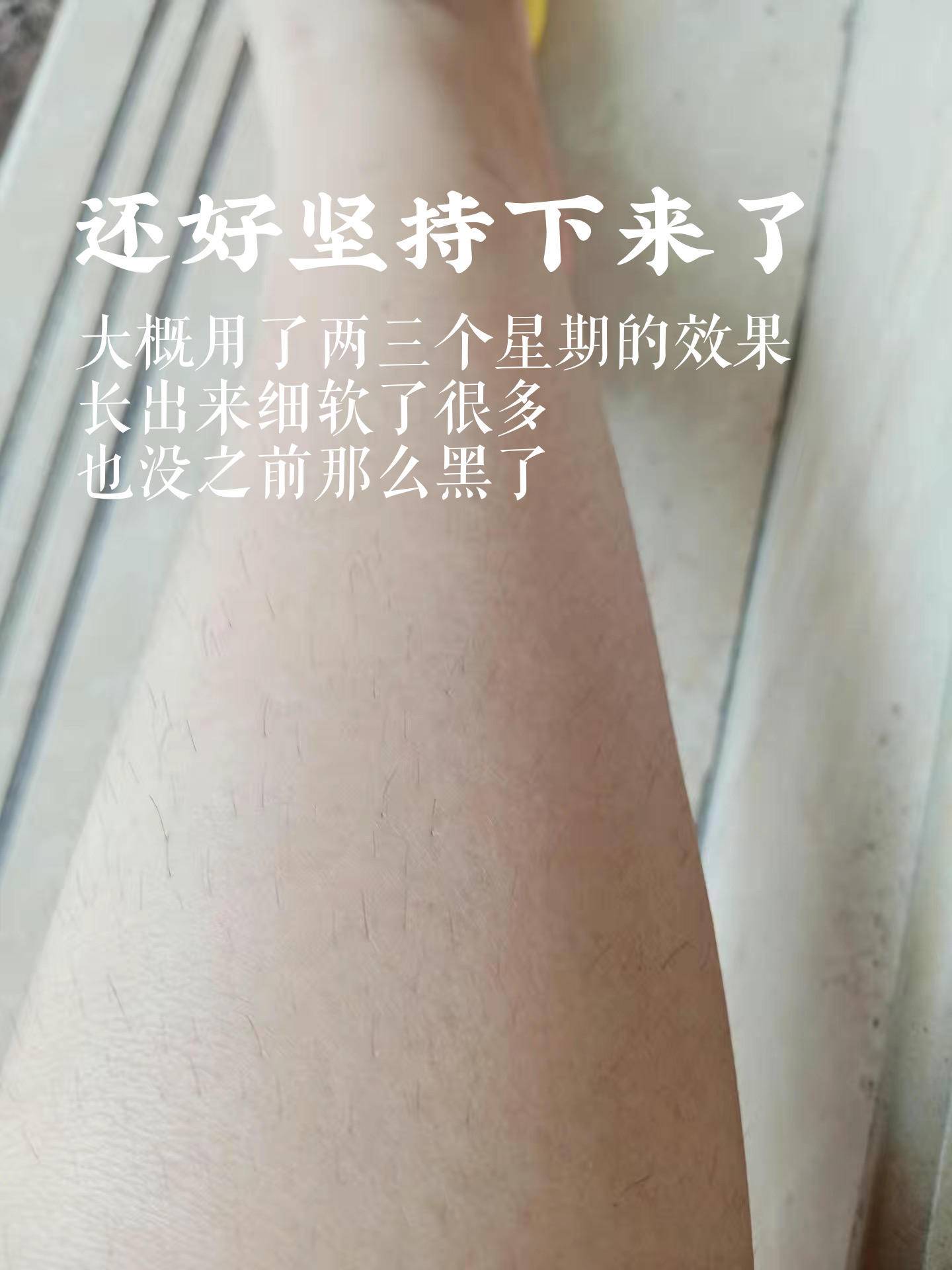 蓝宝石脱毛仪真的能永久去毛吗,ulike蓝宝石3.0脱毛仪