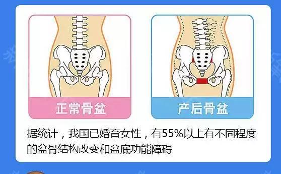梅根产后首次公开亮相,梅根产后多久恢复身材了
