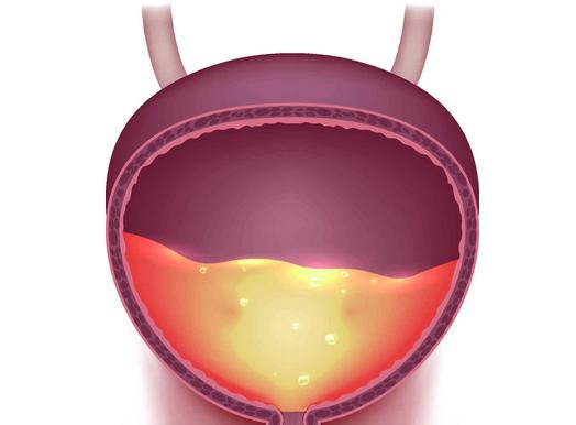 夜尿频繁，要警惕是这3种病的“暗示”，莫大意
