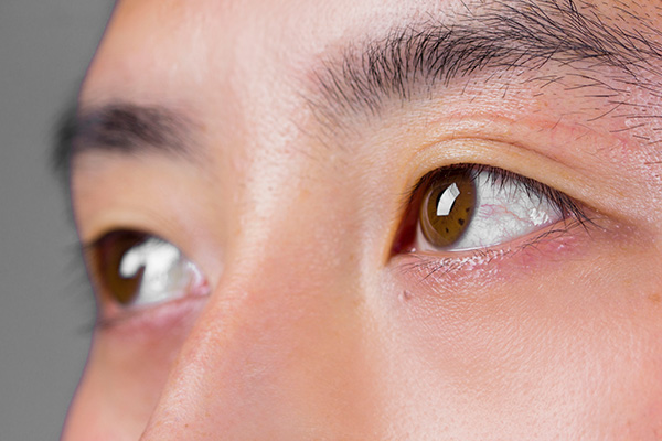 眼部周围长了小痘痘该怎么去除,眼部出现小颗粒痘是怎么回事