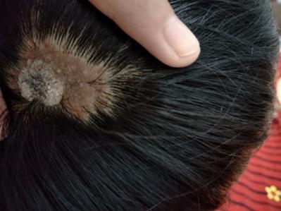 痣出现的位置真的重要吗,痣相大揭秘来看看吧