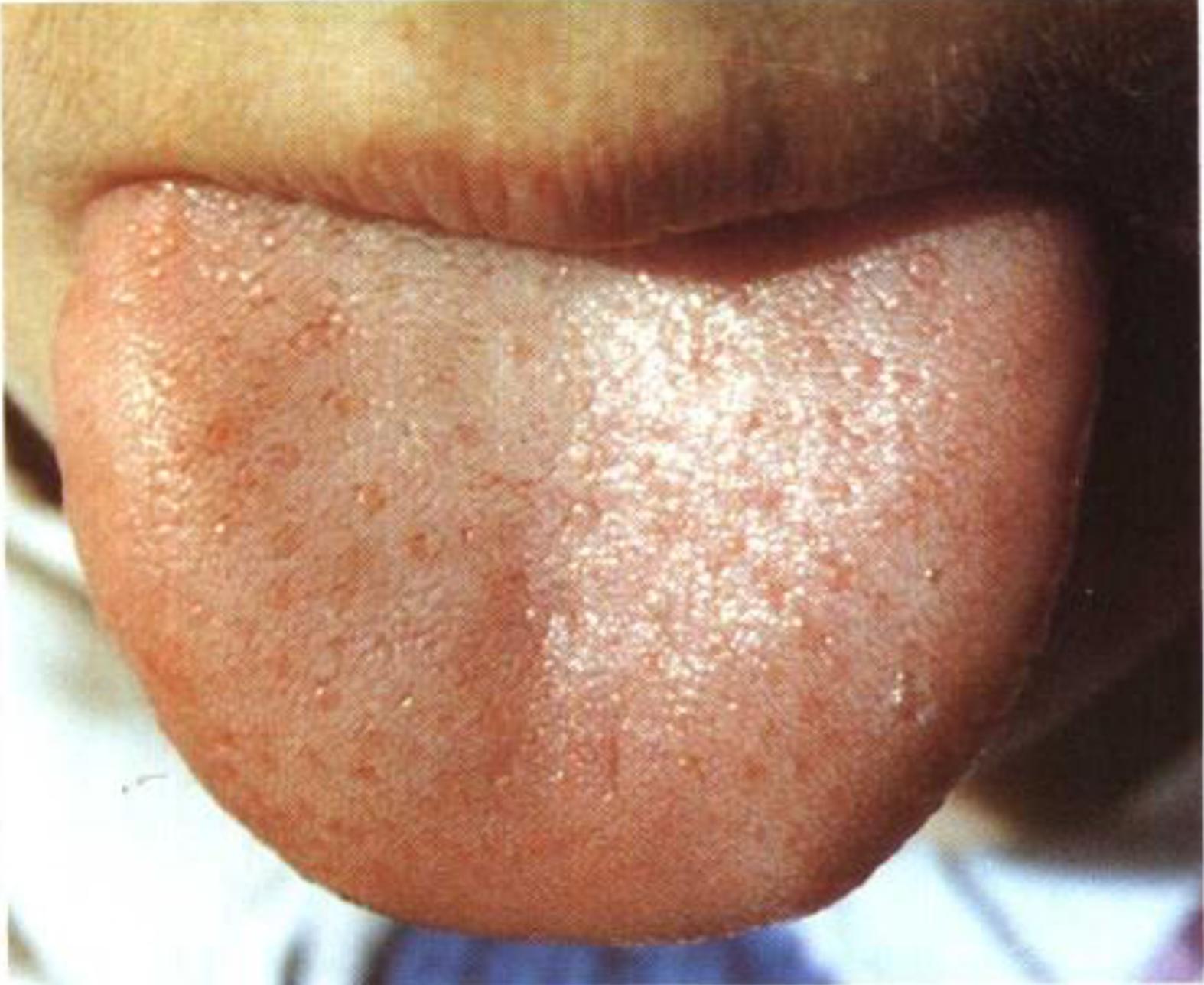 如何从舌苔判断健康,怎样通过舌苔颜色判断身体状况