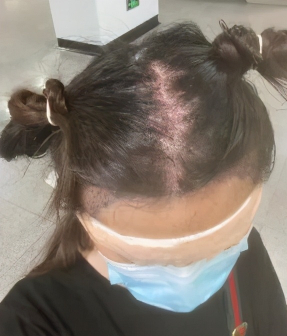 我快秃了图片大全,我快秃了配图