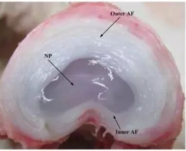 腰椎间盘突出坐骨神经痛如何缓解,腰椎间盘突出脚痛神经痛怎么缓解