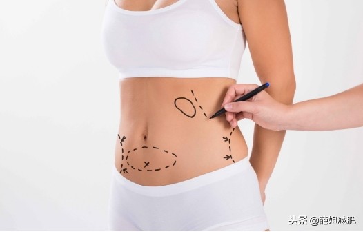 女性腰围异常变“粗”，不一定是长胖，小心卵巢癌找上门