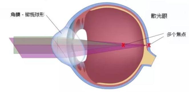 网上配镜眼镜框选择攻略,网上配眼镜如何选择镜片和镜架