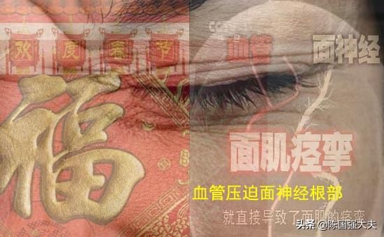 面肌痉挛怎么做可以缓解,面肌痉挛的自我缓解方法