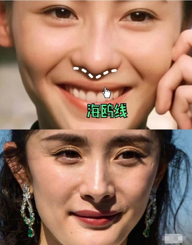 盘点一些有问题的鼻子,明星都没整好的鼻子