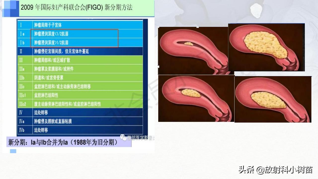 女性盆腔mri解剖图谱,泌尿生殖系统x线解剖