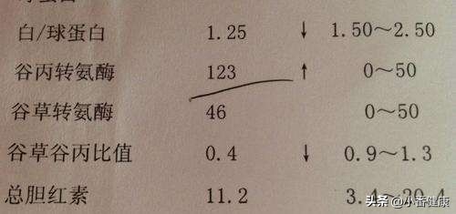 乙肝大三阳传染途径及防治方法,乙肝大三阳需要注意哪些问题