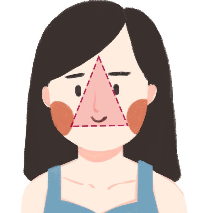 挤痘一定要挤出血吗,徒手挤了痘痘怎么办