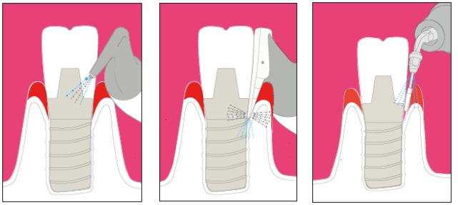 德州口腔医院洗牙团购,德州牙科整牙