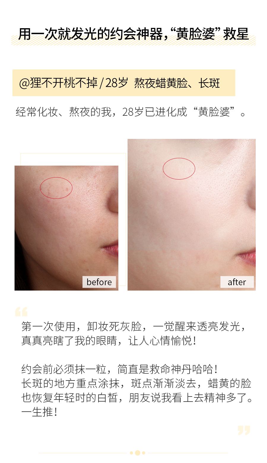 琚佸濮楄憽钀勭苯绮惧崕,琚佸濮楁帹鑽愯憽钀勭苯鎶よ偆