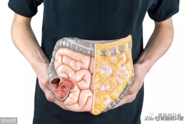 大便变细就是得了肠癌?医生说:不一定,还有这些可能