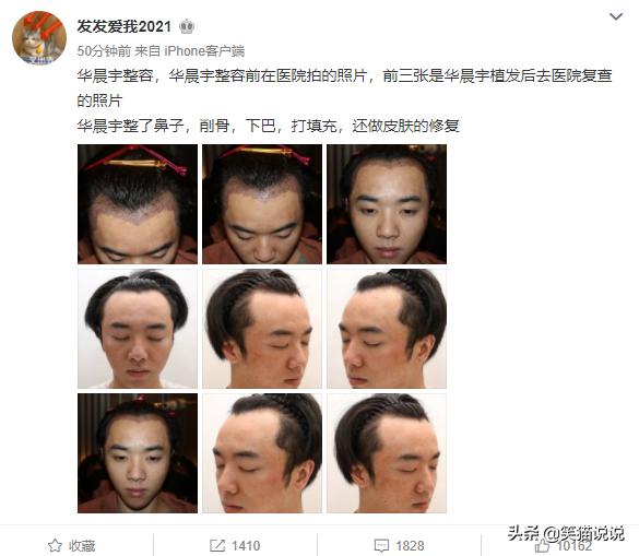 造谣华晨宇整容的网友道歉：前经纪人好友供图，要求华晨宇别计较