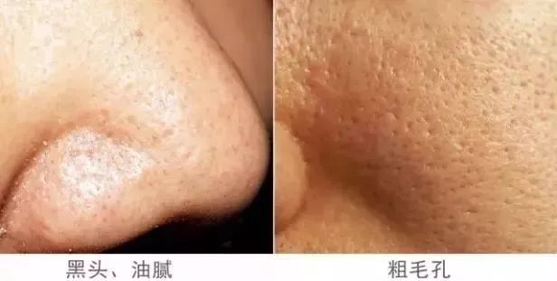 一块值得回购10000次的驴奶皂，必须买它！买它