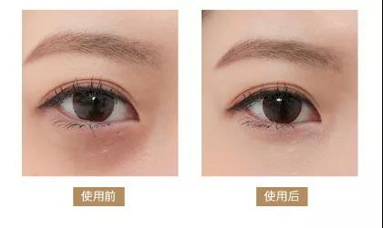 为什么眼睛大会显老？黑眼圈、眼袋、眼纹怎么去除？这两招就够了