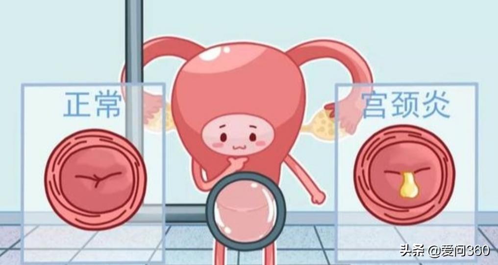 妇科炎症是不是不注意清洁,妇科不注意卫生会引发什么