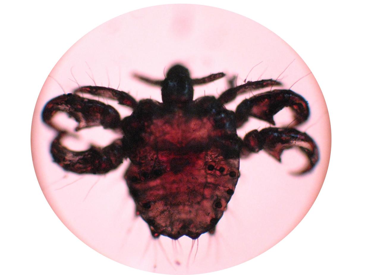 6岁孩子说眼睛痒眨眼怎么回事,小孩眼睛痒是有虫子吗