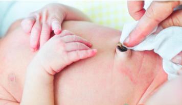 新生儿脐带很脆弱:出血、流水、发炎、发红、不脱落如何护理?