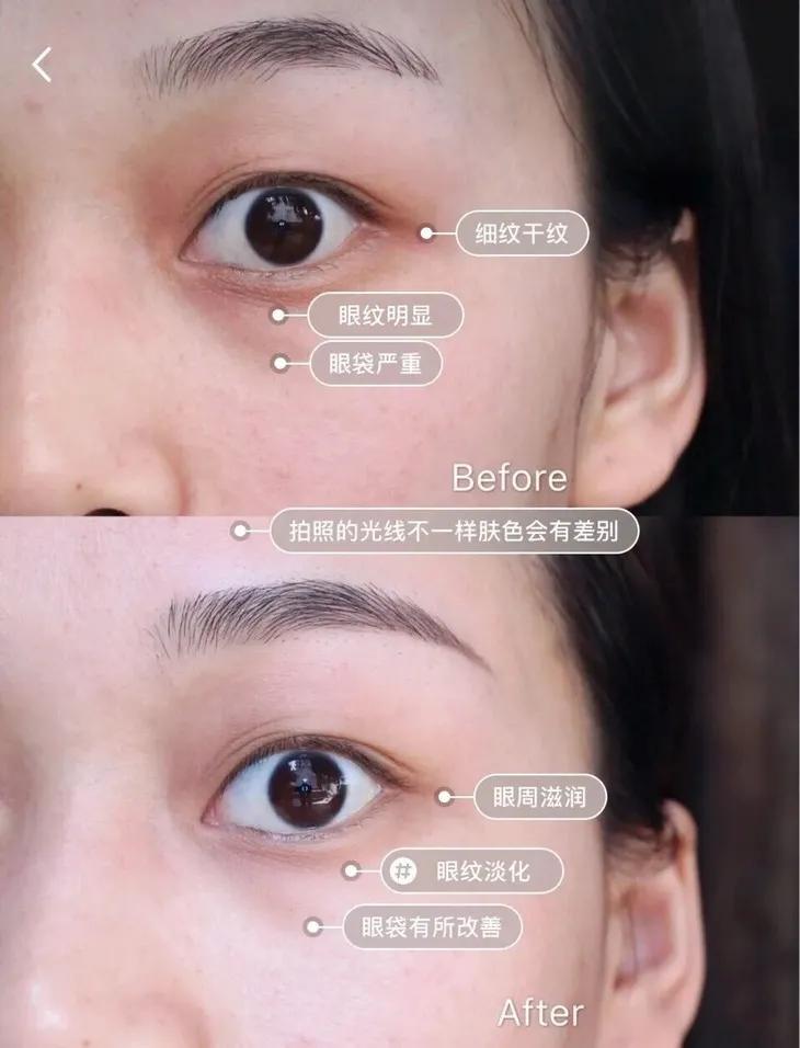 眼部保养重在“润”，用它一喷好舒服！细纹都慢慢膨了起来