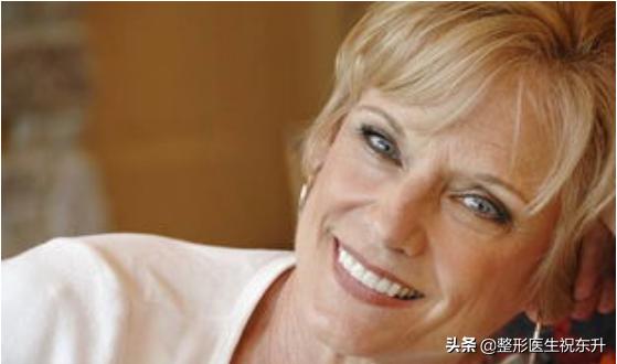 40岁做拉皮手术会年轻几岁,年龄大了做拉皮手术图片