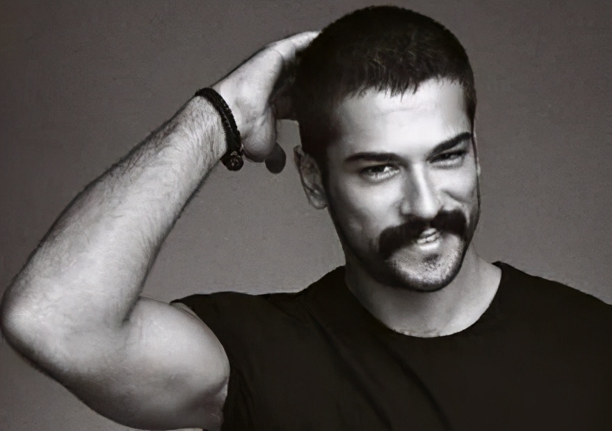 中国人植发,植发的外国人