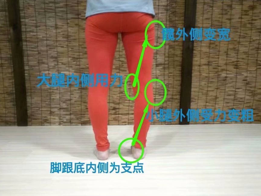 扁平足的腿型怎么改善,扁平足导致腿粗怎么办