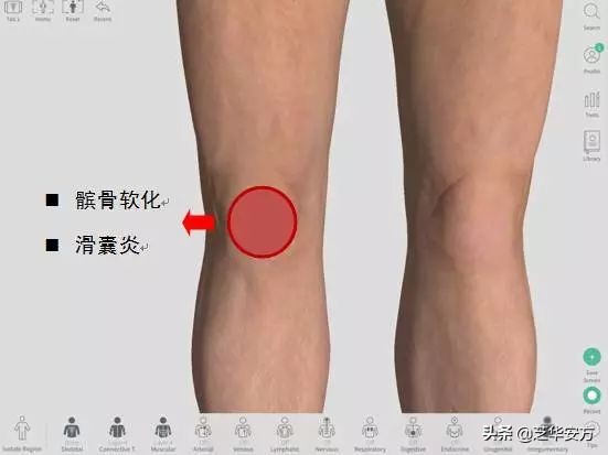 跑姿不对造成的膝盖疼多久能好,膝盖不同位置疼痛代表什么