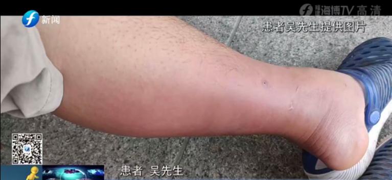 一个人在家里被大狗咬了,宠物猫咬主人一口主人被截肢