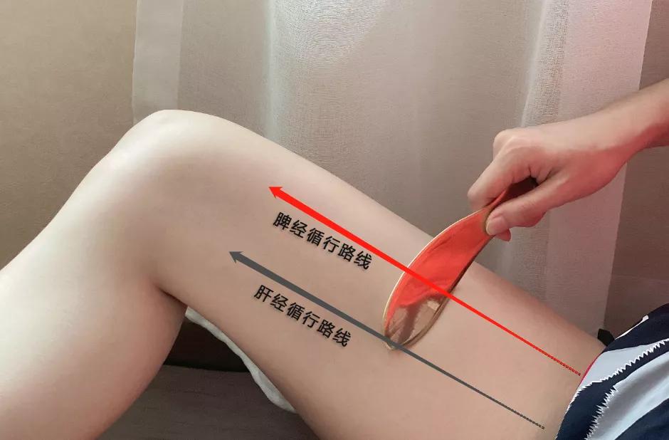 刮痧祛三焦湿热,刮痧头部两侧胆经