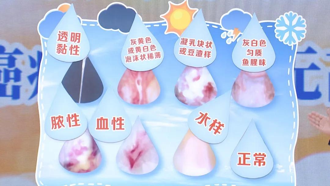 白带异常妇科疾病案例,白带异常就是妇科病前兆