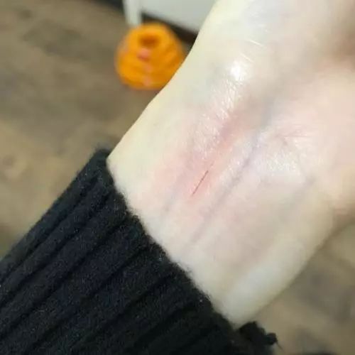 被猫舔证明什么,被猫咪舔过伤口真的会死吗