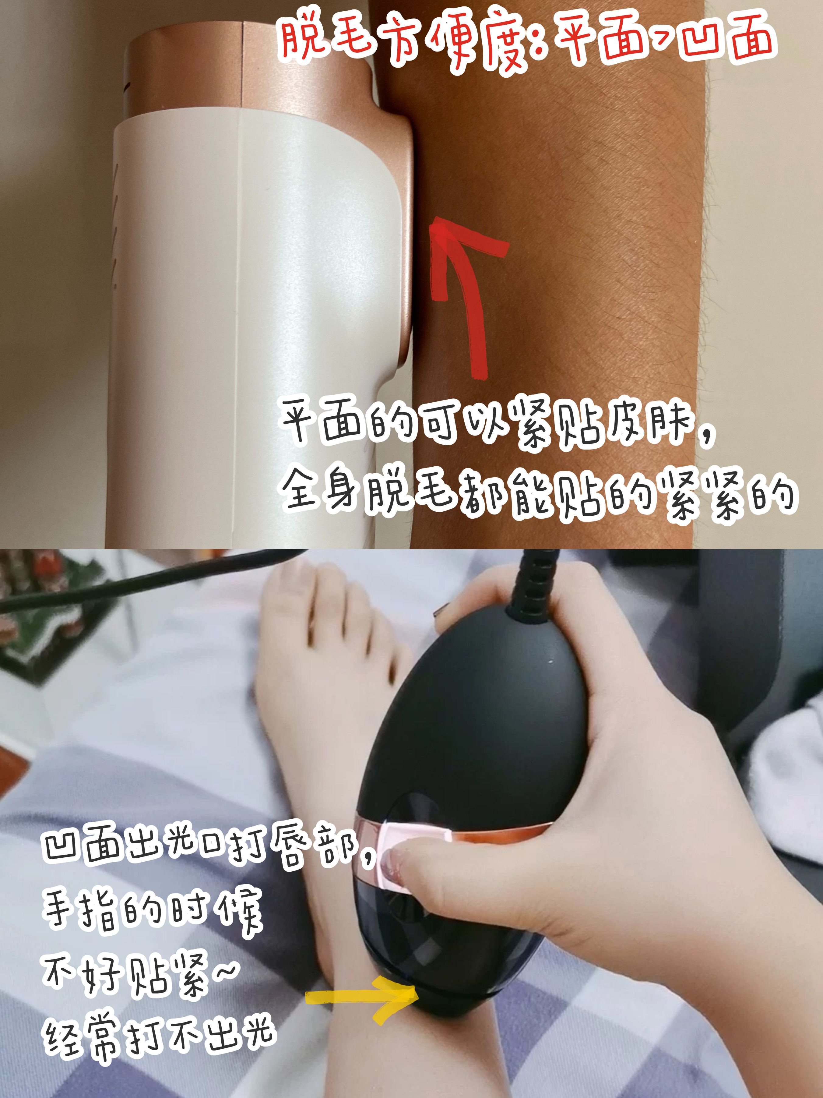 脱毛仪出光颜色有啥区别,脱毛仪平面出光口和凹面哪个好