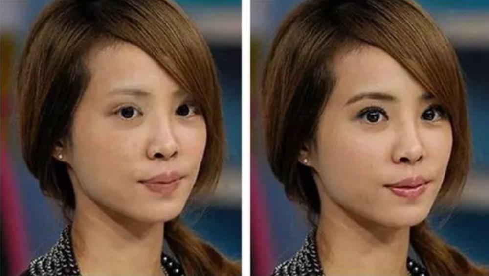 不同地方的痣分别代表着什么,不同地方的痣表示的是什么样的人