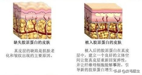 猪蹄膏敷脸的功效,猪蹄膏护肤