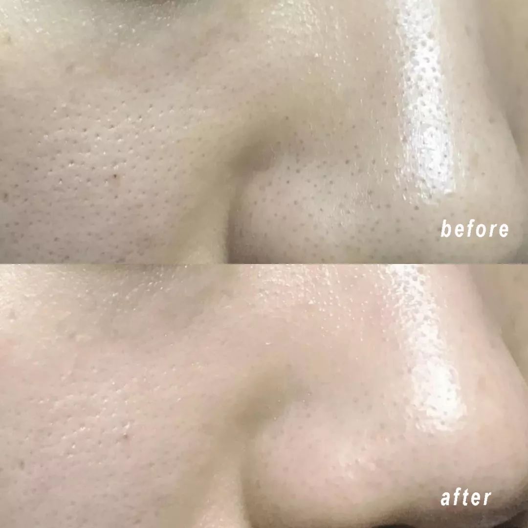 清洁面膜测评真实,清洁面膜测评打假