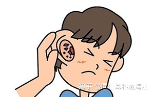 油耳朵的油是怎么来的？