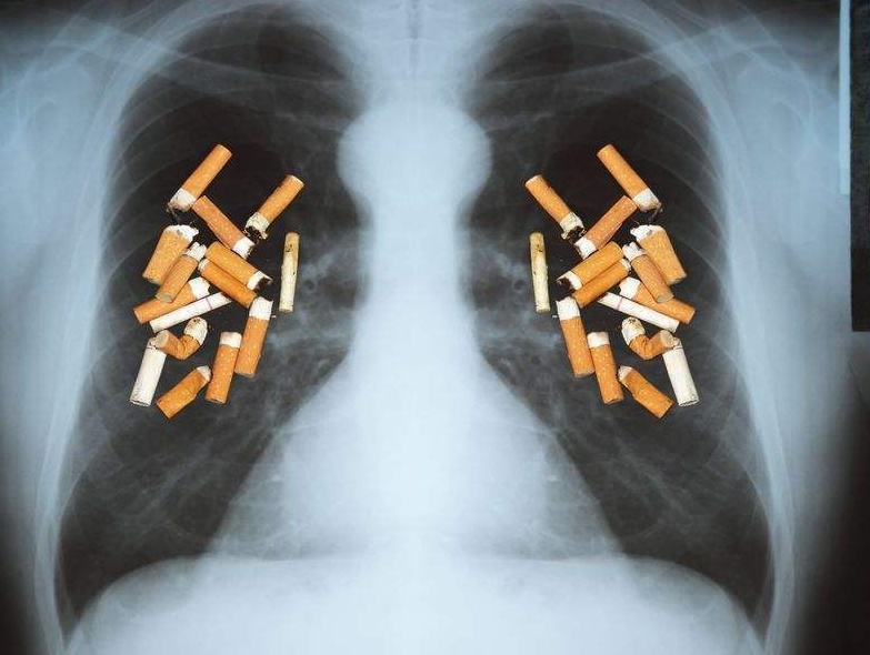 虎子哥抗癌第一人,患癌博主虎子